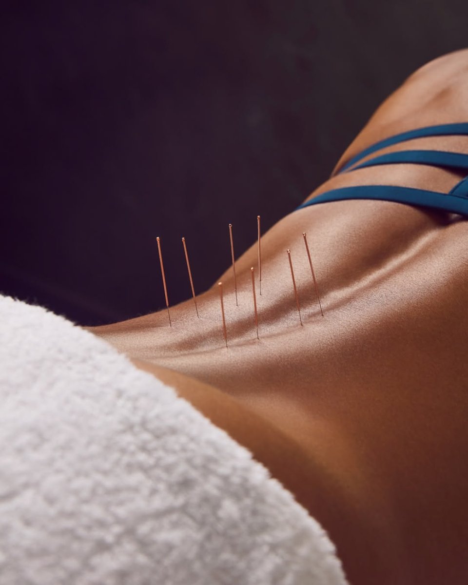 Acupuntura clínica con agujas de precisión
