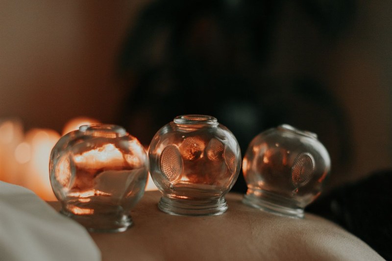Ventosaterapia con copas de vidrio a la luz de velas